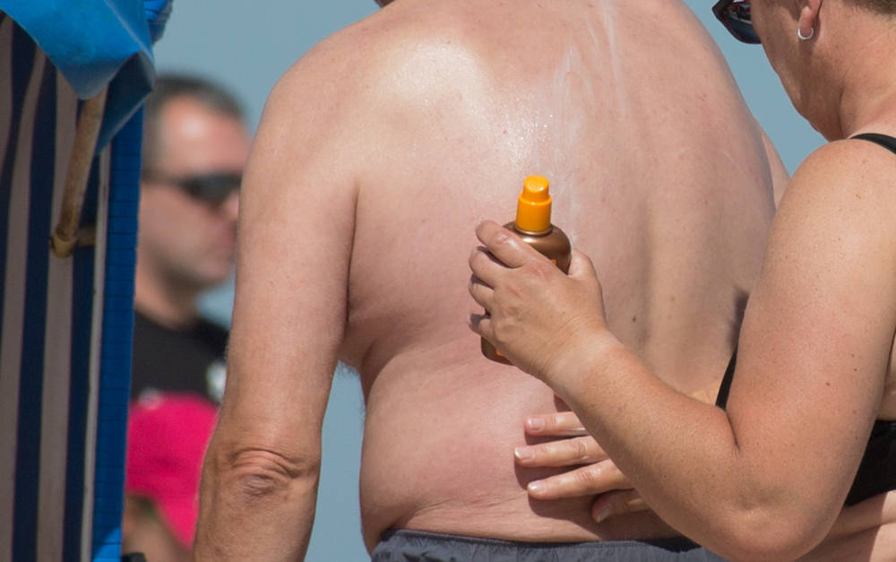 Eincremen ist eine gute Idee: Schließlich gehören schwere Sonnenbrände zu den häufigsten Erkrankungen im Urlaub der Deutschen